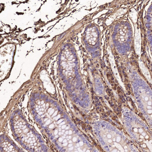 IGHG1 Antibody Human Colon IHC. Immunohistochemistry was performed on paraffin-embedded human colon tissue using IGHG1 Antibody at a 1:100 dilution. Scattered cytoplasmic staining is observed in plasma cells within the colonic lamina propria, while the epithelial cells of the colonic crypts remain largely unstained. This staining pattern is consistent with the expected localization of human IgG1-producing plasma cells in normal colonic mucosa. These results demonstrate that this Human IgG Antibody is suitable for immunohistochemical detection of IGHG1 in formalin-fixed, paraffin-embedded human tissues.