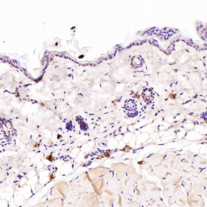 IGHG1 Antibody Mouse Skin IHC. Immunohistochemistry was performed on paraffin-embedded mouse skin tissue using IGHG1 Antibody at a 1:100 dilution. Scattered cytoplasmic staining is observed in immune cells within the dermis, while the epidermis and surrounding skin structures exhibit minimal background staining. This staining pattern is consistent with the expected localization of IgG1-positive immune cells in normal skin. These results demonstrate that this Human IgG Antibody is suitable for immunohistochemical detection of IGHG1 in formalin-fixed, paraffin-embedded tissues.