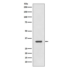 HLA-DRA Antibody for WB testing of human Raji cell lysate by western blot. Recombinant rabbit monoclonal HLA-DRA antibody (clone FGI-8) detects a band at approximately 34 kDa, consistent with the predicted molecular weight of Human leukocyte antigen DR alpha / HLA-DRA, the HLA-DR alpha chain of the MHC class II antigen presentation complex.