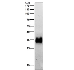 HLA-DRA Antibody for WB testing of rat spleen tissue lysate by western blot. A band is detected at approximately 34 kDa, consistent with the predicted molecular weight of Human leukocyte antigen DR alpha / HLA-DRA, the HLA-DR alpha chain of the MHC class II antigen presentation complex expressed in immune cells present in spleen tissue.