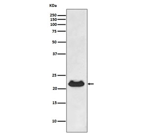 Alpha B Crystallin Antibody Fetal Heart WB. Western blot testing of human fetal heart lysate with Alpha B Crystallin antibody. Predicted molecular weight ~20 kDa.