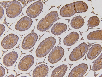 IHC staining of FFPE rat testis with EHD1 antibody. HIER: boil tissue sections in pH6, 10mM citrate buffer, for 10-20 min and allow to cool before testing.