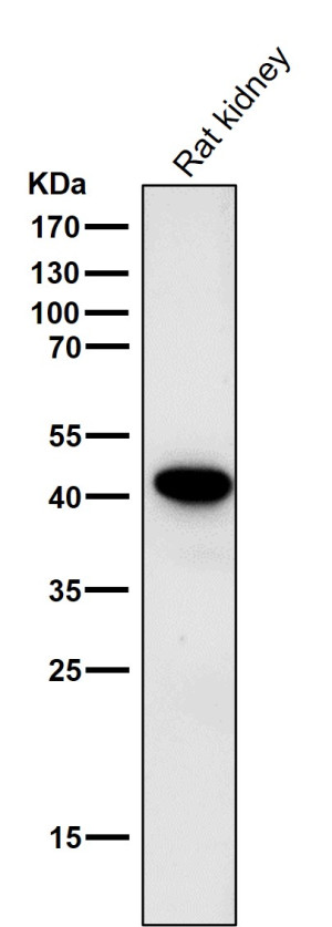 CD235a Antibody in Rat Kidney WB. Western blot testing of CD235a Antibody ADOG-7 / Erythroid Marker Antibody in rat kidney lysate. The antibody was used at a 1:1,000 dilution for 1 hour at RT. A strong, discrete band is observed at approximately 40-42 kDa, with minimal additional background. The observed band indicates recognition of a glycophorin A-related protein in the tested rat kidney lysate.