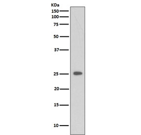 Western blot testing of lysate from human 293 cells treated with Etoposide, with C Reactive Protein antibody. Predicted molecular weight ~26 kDa.