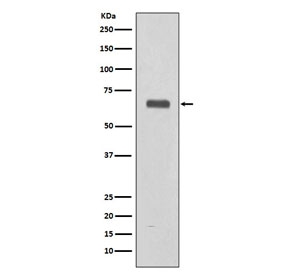 Western blot testing of human fetal liver lysate with C9/Complement component C9 antibody. Expected molecular weight: 63-70 kDa depending on the level of glycosylation.