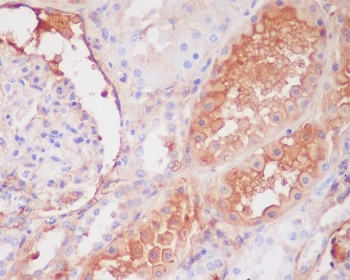 IHC staining of FFPE human kidney tissue with C9/Complement component C9 antibody. HIER: boil tissue sections in pH6, 10mM citrate buffer, for 10-20 min and allow to cool before testing.