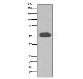 VDBP Antibody Human Plasma WB. Western blot testing of human plasma lysate with VDBP antibody. Predicted molecular weight ~53 kDa.