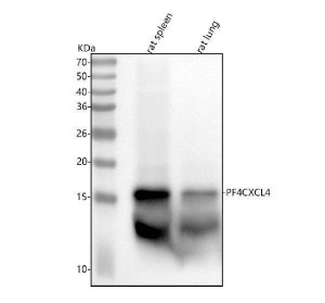 PF4 Antibody Rat Tissue WB. Western blot testing of rat spleen and rat lung tissue lysates with PF4 Antibody. Lane 1: rat spleen; Lane 2: rat lung. A specific band was detected at approximately 15 kDa, consistent with detection of Platelet Factor 4. PF4 has a predicted monomeric molecular weight of approximately 8-11 kDa and is known to form higher molecular weight oligomers, including dimeric and tetrameric structures. PF4 Antibody / Platelet Activation Marker Antibody supports analysis of platelet-derived chemokine expression, alpha granule biology and platelet activation signaling pathways.