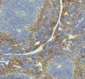 PF4 Antibody Mouse Spleen IHC. Immunohistochemistry staining of FFPE mouse spleen tissue with PF4 Antibody at 1:50 dilution. HIER was performed using pH 8 EDTA buffer, followed by blocking with 10% goat serum. The tissue section was incubated with rabbit anti-PF4 antibody overnight at 4Â°C, followed by HRP-conjugated goat anti-rabbit IgG secondary antibody and DAB chromogen detection. PF4 Antibody / Platelet Activation Marker Antibody demonstrates staining consistent with platelet-derived chemokine expression and supports studies of platelet activation, alpha granule biology and immune regulation pathways.