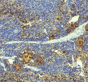 PF4 Antibody Mouse Spleen Germinal Center IHC. Immunohistochemistry staining of FFPE mouse spleen tissue with PF4 Antibody at 1:50 dilution. HIER was performed using pH 8 EDTA buffer, followed by blocking with 10% goat serum. The tissue section was incubated with rabbit anti-PF4 antibody overnight at 4Â°C, followed by HRP-conjugated goat anti-rabbit IgG secondary antibody and DAB chromogen detection. PF4 Antibody / Platelet Activation Marker Antibody demonstrates staining of platelet-associated regions consistent with Platelet Factor 4 expression and supports studies of platelet activation, alpha granule release and immune signaling pathways.
