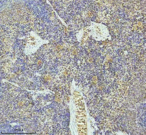PF4 Antibody Rat Spleen IHC. Immunohistochemistry staining of FFPE rat spleen tissue with PF4 Antibody at 1:50 dilution. HIER was performed using pH 8 EDTA buffer, followed by blocking with 10% goat serum. The tissue section was incubated with rabbit anti-PF4 antibody overnight at 4Â°C, followed by HRP-conjugated goat anti-rabbit IgG secondary antibody and DAB chromogen detection. PF4 Antibody / Platelet Activation Marker Antibody demonstrates staining consistent with Platelet Factor 4 expression in platelet-rich regions and supports studies of platelet activation, alpha granule biology and immune signaling pathways.