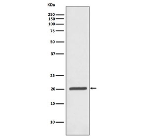Ferritin Antibody WB. Western blot testing of human Jurkat antibody with Ferritin antibody. Predicted molecular weight ~21 kDa.