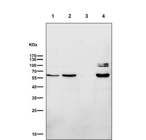 Western blot testing of human 1) HepG2, 2) SW480, 3) SK-OV-3 and 4) MCF7 cell lysate with ER alpha antibody. Predicted molecular weight ~66 kDa.