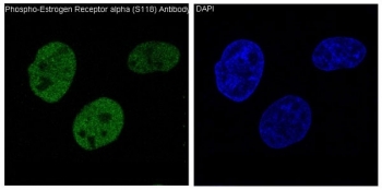 Phospho-ER alpha (pS118) Antibody Kidney Tissue IHC. Immunohistochemistry of FFPE human kidney tissue using phospho-ER alpha (pS118) antibody shows HRP-DAB brown nuclear staining in epithelial cells, consistent with phosphorylation at serine 118 and activation of ESR1 signaling, while surrounding stromal elements display lower background; detection was performed with clone EIG-5. HIER: boil tissue sections in pH6 citrate buffer for 20 min and allow to cool before testing.