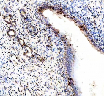 Phospho-ER alpha (pS118) Antibody Rat Uterus IHC. Immunohistochemistry of FFPE rat uterus tissue using phospho-ER alpha (pS118) antibody demonstrates HRP-DAB brown nuclear staining in uterine epithelial and stromal cells, consistent with estrogen-responsive phosphorylation at serine 118 and active ESR1 signaling in reproductive tissue, while background staining remains minimal; detection was performed with clone EIG-5. HIER: boil tissue sections in pH8 EDTA for 20 min and allow to cool before testing.