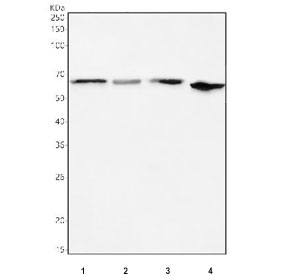 Phospho-ER alpha (pS118) Antibody Mouse Rat WB. Western blot testing of 1) rat brain, 2) rat C6, 3) mouse brain and 4) mouse Neuro-2a cell lysate with phospho-ER alpha antibody. Predicted molecular weight ~66 kDa.
