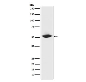 Collagenase 1 Antibody Recombinant Protein WB. Western blot analysis of purified human recombinant Collagenase 1 protein using Collagenase 1 Antibody. A single specific band is detected at approximately 54 kDa, consistent with the predicted molecular weight of the MMP1 proenzyme (pro-MMP1). Recognition of recombinant protein confirms target specificity under Western blot conditions. These results support the use of Collagenase 1 Antibody for studying MMP1 expression, extracellular matrix remodeling and collagen degradation pathways.
