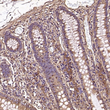 Collagenase 1 Antibody Human Colon IHC. Immunohistochemistry analysis of FFPE human colon tissue using Collagenase 1 Antibody. Heat induced antigen retrieval was performed by boiling tissue sections in pH 6 citrate buffer for 10â20 minutes prior to staining. Positive staining is observed predominantly in stromal and inflammatory cell populations surrounding the colonic crypts, consistent with MMP1 expression associated with extracellular matrix remodeling and tissue homeostasis. These results support the use of Collagenase 1 Antibody for studying MMP1 expression, collagen degradation and extracellular matrix remodeling in normal gastrointestinal tissue.