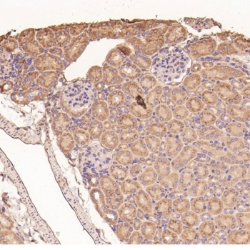 Collagenase 1 Antibody Mouse Kidney IHC. Immunohistochemistry analysis of FFPE mouse kidney tissue using Collagenase 1 Antibody. Heat induced antigen retrieval was performed by boiling tissue sections in pH 6 citrate buffer for 10â20 minutes prior to staining. Predominantly cytoplasmic staining is observed in renal tubular epithelial cells, consistent with MMP1 expression associated with extracellular matrix remodeling and tissue homeostasis. These results support the use of Collagenase 1 Antibody for studying MMP1 expression, collagen degradation and extracellular matrix remodeling in renal tissues.