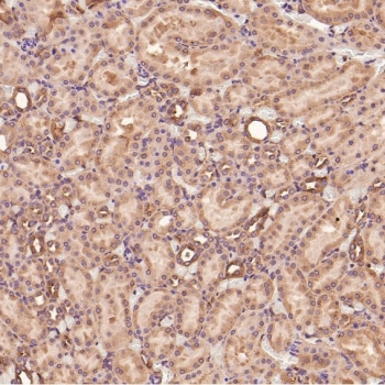 Collagenase 1 Antibody Rat Kidney IHC. Immunohistochemistry analysis of FFPE rat kidney tissue using Collagenase 1 Antibody. Heat induced antigen retrieval was performed by boiling tissue sections in pH 6 citrate buffer for 10â20 minutes prior to staining. Predominantly cytoplasmic staining is observed in renal tubular epithelial cells, consistent with MMP1 expression associated with extracellular matrix remodeling and normal tissue homeostasis. These results support the use of Collagenase 1 Antibody for studying MMP1 expression, collagen degradation and extracellular matrix remodeling in renal tissues.