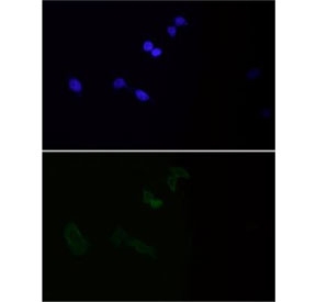 Collagenase 1 Antibody HeLa Cell IF. Immunofluorescence analysis of FFPE human HeLa cells using Collagenase 1 Antibody. Heat induced antigen retrieval was performed by boiling sections in pH 6 citrate buffer for 20 minutes prior to staining. Collagenase 1 expression is shown in green with DAPI nuclear counterstain shown in blue. Predominantly cytoplasmic staining is observed, consistent with intracellular synthesis and processing of the MMP1 proenzyme before secretion. These results support the use of Collagenase 1 Antibody for studying MMP1 expression, collagen degradation and extracellular matrix remodeling.