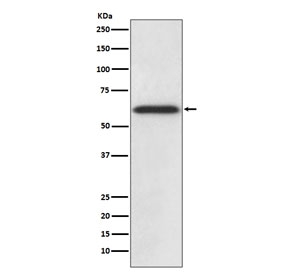 Catalase Antibody / Peroxisomal Antioxidant Enzyme WB. Western blot analysis of human HepG2 cell lysate using Catalase Antibody / Peroxisomal Antioxidant Enzyme, clone AAGA-3. A distinct immunoreactive band is detected at approximately 60 kDa, consistent with the predicted molecular weight of catalase, supporting specific detection of the endogenous peroxisomal antioxidant enzyme in human HepG2 cells.