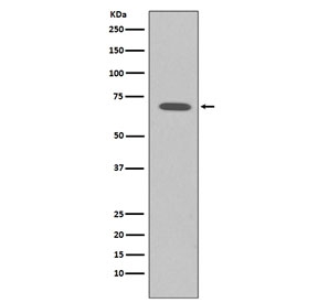 Western blot testing of human K562 cell lysate with Raf1 antibody. Predicted molecular weight ~73 kDa.