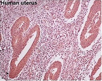 IHC staining of FFPE human uterus with GAPDH antibody. HIER: boil tissue sections in pH6, 10mM citrate buffer, for 10-20 min and allow to cool before testing.