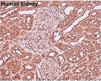 IHC staining of FFPE human kidney with GAPDH antibody. HIER: boil tissue sections in pH6, 10mM citrate buffer, for 10-20 min and allow to cool before testing.