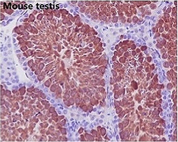 IHC staining of FFPE mouse testis with GAPDH antibody. HIER: boil tissue sections in pH6, 10mM citrate buffer, for 10-20 min and allow to cool before testing.