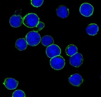 HER2 Antibody SK-BR-3 Cell IF. Immunofluorescent staining of human SK-BR-3 cells with HER2 antibody (green) and DAPI nuclear stain (blue).