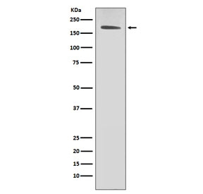 HER2 Antibody SK-BR-3 Cell WB. Western blot testing of human SK-BR-3 cell lysate with HER2 antibody.