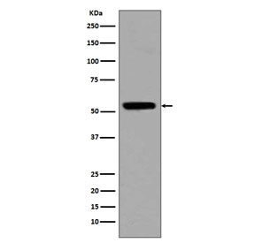 p53 (Acetyl Lys370) Antibody TSA-Treated HeLa Cell WB. Western blot analysis of human HeLa cell lysate treated with Trichostatin A (TSA) was performed with p53 (Acetyl Lys370) Antibody, also called Acetyl-p53 K370 Antibody. A specific band is detected at approximately 53 kDa, consistent with the predicted molecular weight of p53. This p53 (Acetyl Lys370) Antibody demonstrates detection of Lys370-acetylated TP53 following histone deacetylase inhibition and supports studies of acetylation-dependent p53 regulation.