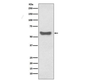 Western blot IgA Antibody Rabbit Monoclonal AOII-9 in human serum. Human serum lysate was analyzed by western blot using IgA Antibody Rabbit Monoclonal AOII-9. A band is detected at approximately 55-60 kDa, consistent with the predicted molecular weight of the Immunoglobulin alpha heavy chain (IGHA), which forms the heavy chain component of IgA antibodies. The detected band corresponds to the IgA heavy chain present in circulating serum immunoglobulins and reflects the expected migration of reduced IgA heavy chains during SDS-PAGE analysis.