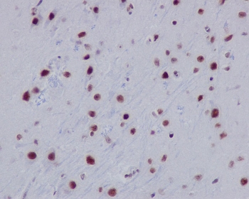 Acetyl-Histone H2A Antibody Lys9 / HIST1H2A Chromatin Accessibility Antibody (clone DEB-8) for IHC. Immunohistochemistry of HIST1H2A / Histone H2A Lys9 acetylation (H2AK9ac) in mouse brain tissue. Formalin-fixed, paraffin-embedded mouse brain sections show strong HRP-DAB brown nuclear staining in neuronal and glial cells, consistent with nuclear localization of acetylated Histone H2A and chromatin accessibility. Heat-induced epitope retrieval was performed using pH6 citrate buffer.