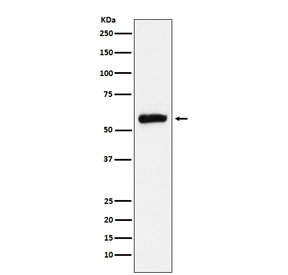 Western blot testing of human HepG2 cell lysate with ALDH2 antibody. Predicted molecular weight ~56 kDa.
