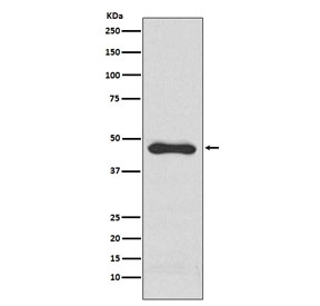 Western blot testing of human HepG2 cell lysate with PAI-1/Plasminogen activator inhibitor 1 antibody. Predicted molecular weight ~45 kDa.