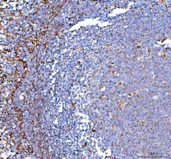 IHC staining of FFPE human tonsil tissue with PPA2 antibody. HIER: boil tissue sections in pH8 EDTA for 20 min and allow to cool before testing.