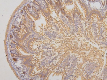 IHC staining of FFPE rat intestine with RAB3GAP2 antibody. HIER: boil tissue sections in pH6, 10mM citrate buffer, for 20 min and allow to cool before testing.