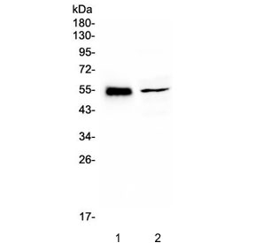 Western blot testing of 1) rat heart and 2) mouse testis lysate with RBMS3 antibody. Expected molecular weight: 48-55 kDa.