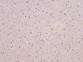 IHC staining of FFPE rat brain with RBMS3 antibody. HIER: boil tissue sections in pH6, 10mM citrate buffer, for 20 min and allow to cool before testing.