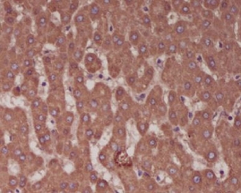 ALPL Antibody Liver IHC. Immunohistochemistry staining of FFPE human liver tissue with ALPL antibody. HIER: boil tissue sections in pH6, 10mM citrate buffer, for 10-20 min and allow to cool before testing.