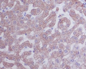 IHC staining of FFPE human human liver with Keratin 8 antibody. HIER: boil tissue sections in pH6, 10mM citrate buffer, for 10-20 min and allow to cool before testing.