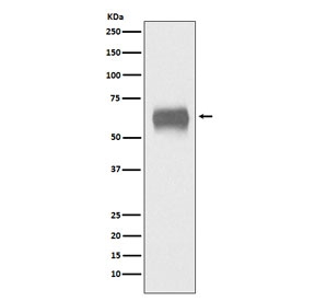 CD5 Antibody for WB. Western blot analysis of CD5 antibody in human plasma lysate using a plasma CD5 detection antibody, clone ACII-3. A band is detected at approximately 55-67 kDa, consistent with the predicted molecular weight of CD5, with size variation reflecting known glycosylation of this membrane glycoprotein. Detection in plasma highlights the ability of this antibody to recognize circulating CD5 in a complex biological fluid, supporting its use for studies of extracellular immune markers and systemic immune signaling.