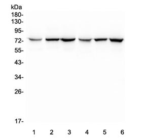 Western blot testing of 1) rat kidney, 2) rat spleen, 3) rat lung, 4) mouse kidney, 5) mouse spleen and 6) mouse lung lysate with SGLT2 antibody. Predicted molecular weight ~73 kDa.