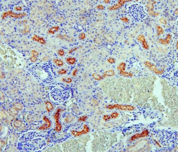 IHC staining of FFPE rat kidney with SGLT2 antibody. HIER: boil tissue sections in pH6, 10mM citrate buffer, for 20 min and allow to cool before testing.