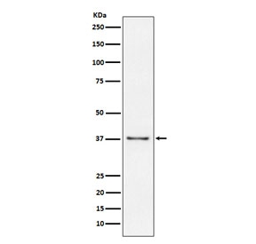 CD23 Antibody Raji Cell WB. Western blot testing of human Raji cell lysate with CD23 antibody. Expected molecular weight: 37-45 kDa.