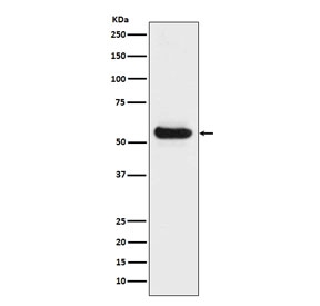 LPL Antibody Human Fetal Liver Western Blot. Western blot analysis of human fetal liver lysate using LPL Antibody / Lipid Metabolism Enzyme Antibody demonstrates a distinct band at approximately 53 kDa, consistent with the predicted molecular weight of Lipoprotein Lipase (LPL). LPL is a key enzyme involved in triglyceride hydrolysis, fatty acid mobilization, and lipid utilization, facilitating the release of free fatty acids from circulating lipoproteins for cellular uptake and metabolic activity. Detection of LPL in fetal liver tissue is consistent with the important role of lipid metabolism and nutrient processing during development, where efficient lipid utilization supports cellular growth, tissue maturation, and metabolic homeostasis.