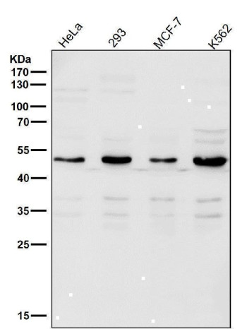 LPL Antibody Multi-Cell Line Western Blot. Western blot analysis of human HeLa, HEK293, MCF-7, and K562 cell lysates using LPL Antibody demonstrates a prominent band at approximately 48-50 kDa across all tested cell lines, consistent with the expected molecular weight range of Lipoprotein Lipase (LPL). LPL is a key enzyme involved in triglyceride hydrolysis, fatty acid mobilization, and lipid utilization, facilitating the release of free fatty acids from circulating lipoproteins for cellular uptake and energy metabolism. Detection of LPL in multiple human cell lines supports its role in lipid processing and metabolic regulation across diverse cellular contexts. All lanes were probed using antibody diluted 1:2000 for 1 hour at room temperature.