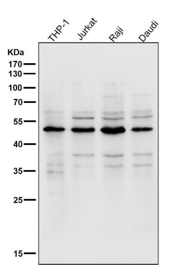 LPL Antibody Hematopoietic Cell Line Western Blot. Western blot analysis of human THP-1, Jurkat, Raji, and Daudi cell lysates using LPL Antibody demonstrates a prominent band at approximately 48-50 kDa across all tested cell lines, consistent with expression of Lipoprotein Lipase (LPL). LPL is a key enzyme involved in triglyceride hydrolysis, fatty acid mobilization, and lipid utilization, facilitating the release of free fatty acids from circulating lipoproteins for cellular uptake and metabolic processes. Detection of LPL in monocyte-, T-cell-, and B-cell-derived cell lines supports its role in cellular lipid handling and energy metabolism across diverse hematopoietic cell populations. All lanes were probed using antibody diluted 1:2000 for 1 hour at room temperature.